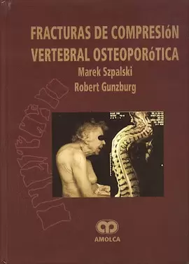 FRACTURAS DE COMPRENSION VERTEBRAL OSTEOPOROTICA
