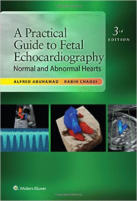 A PRACTICAL GUIDE TO FETAL ECHOCARDIOGRAPHY