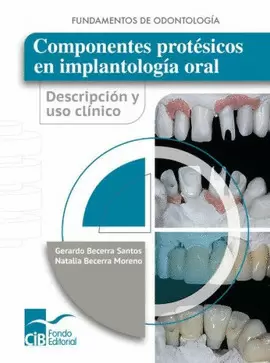 COMPONENTES PROTÉSICOS EN IMPLANTOLOGÍA ORAL. DESCRIPCIÓN Y USO CLÍNICO