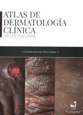 ATLAS DE DERMATOLOGÍA CLÍNICA.