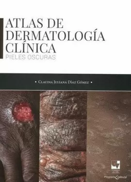 ATLAS DE DERMATOLOGÍA CLÍNICA