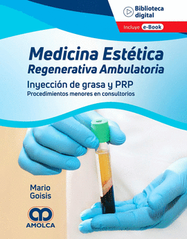 MEDICINA RENEGERATIVA AMBULATORIA. INYECCIÓN DE GRASA Y PRP