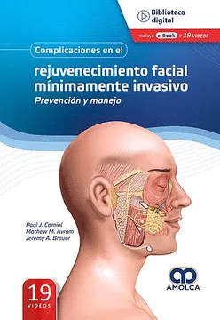 COMPLICACIONES EN EL REJUVENECIMIENTO FACIAL MINIMAMENTE INVASIVO
