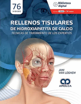 RELLENOS TISULARES DE HIDROXIAPATITA DE CALCIO
