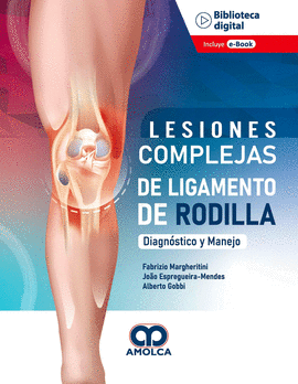 LESIONES COMPLEJAS DE LIGAMENTO DE RODILLA
