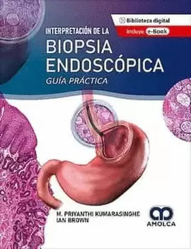 INTERPRETACION DE LA BIOPSIA ENDOSCOPICA. GUIA PRACTICA