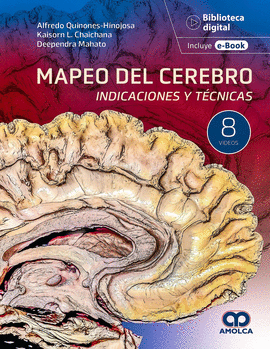 MAPEO DEL CEREBRO. INDICACIONES Y TÉCNICAS