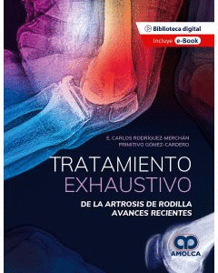 TRATAMIENTO EXHAUSTIVO DE LA ARTROSIS DE RODILLA. AVANCES RECIENTES