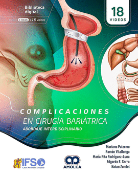 COMPLICACIONES EN CIRUGÍA BARIÁTRICA. ABORDAJE INTERDISCIPLINARIO