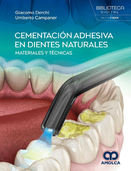 CEMENTACIÓN ADHESIVA EN DIENTES NATURALES. MATERIALES Y TÉCNICAS