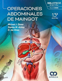 OPERACIONES ABDOMINALES DE MAINGOT