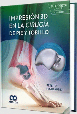 IMPRESIÓN 3D EN LA CIRUGÍA DE PIE Y TOBILLO