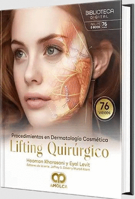 LIFTING QUIRÚRGICO