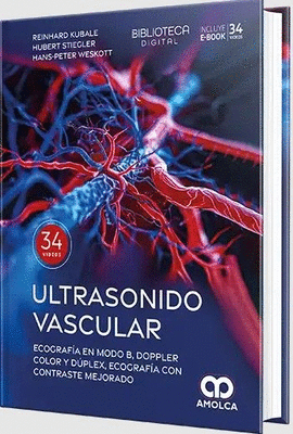 ULTRASONIDO VASCULAR