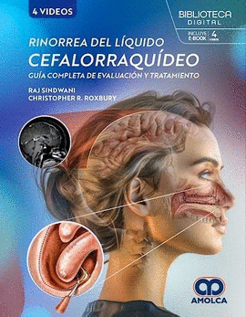RINORREA DEL LÍQUIDO CEFALORRAQUÍDEO