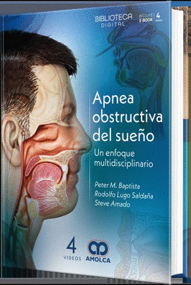APNEA OBSTRUCTIVA DEL SUEÑO