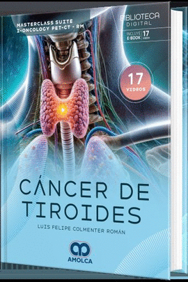 CÁNCER DE TIROIDES