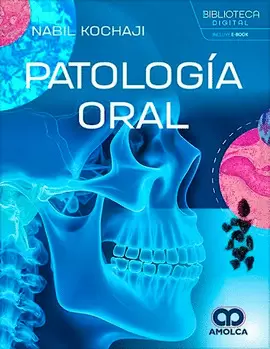 PATOLOGÍA ORAL