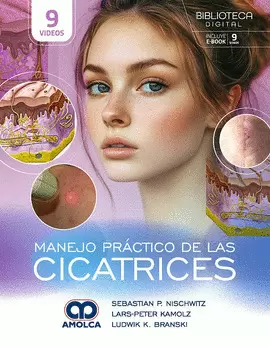 MANEJO PRÁCTICO DE LAS CICATRICES