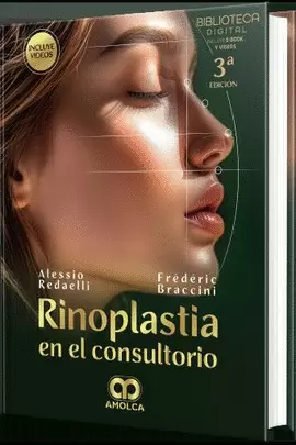 RINOPLASTIA EN EL CONSULTORIO