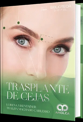 TRASPLANTE DE CEJAS