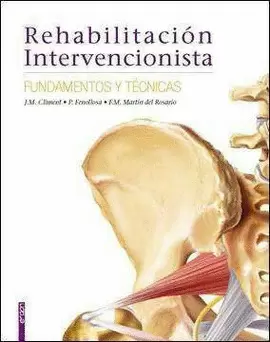 REHABILITACION INTERVENCIONISTA