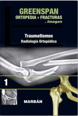 ORTOPEDIA Y FRACTURAS EN IMAGEN (VOL1): TRAUMATISMOS