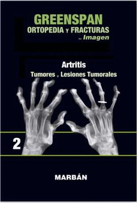 ORTOPEDIA Y FRACTURAS EN IMAGENES (VOL 2): ARTRITIS. TUMORES.