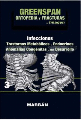 ORTOPEDIA Y FRACTURAS EN IMAGENES(VOL3): INFECCIONES. TRASTORNOS METABOLICOS.ANO