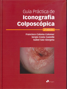 GUÍA PRÁCTICA DE ICONOGRAFÍA COLPOSCÓPICA - 2ª EDICIÓN