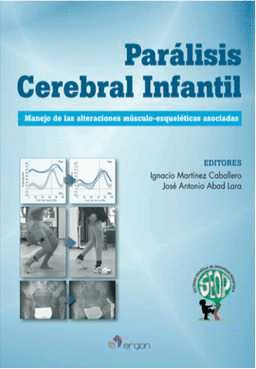 PARÁLISIS CEREBRAL INFANTIL. MANEJO DE LAS ALTERACIONES MÚSCULO-ESQUELÉTICAS ASOCIADAS