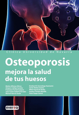 OSTEOPOROSIS. MEJORA LA SALUD DE TUS HUESOS