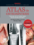 OROZCO ATLAS DE OSTEOSINTESIS (2 VOL) - FRACTURAS DE LOS HUESOS LARGOS VIAS DE ACCESO QUIRURGICO