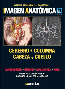 IMAGEN ANATOMICA (HARNSBERGER) - CEREBRO, COLUMNA, CABEZA  Y CUELLO