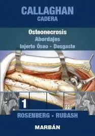 CALLAGHAN CADERA, TOMO 1 2ED: OSTEONECROSIS. ABORDAJES, INJERTO OSEO, DESGASTE