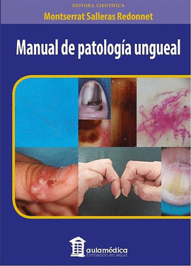 MANUAL DE PATOLOGÍA UNGUEAL