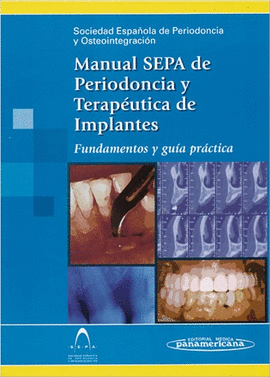 MANUAL SEPA DE PERIODONCIA Y TERAPÉUTICA DE IMPLANTES. FUNDAMENTOS Y GUÍA PRÁCTICA