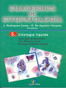 CITOLOGÍA LÍQUIDA