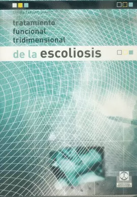 TRATAMIENTO FUNCIONAL TRIDIMENSIONAL DE LA ESCOLIOSIS. 2004.