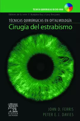 CIRUGÍA DEL ESTRABISMO