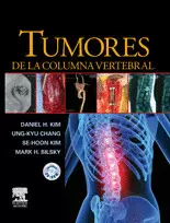 TUMORES DE LA COLUMNA VERTEBRAL
