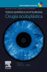 CIRUGIA OCULOPLASTICA+DVD-ROM