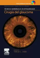 CIRUGIA DEL GLAUCOMA