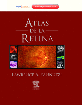 ATLAS DE LA RETINA