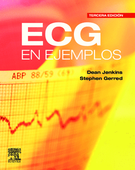 ECG EN EJEMPLOS 3ED
