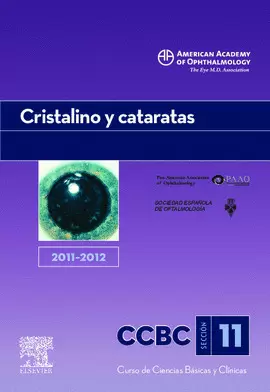 CRISTALINO Y CATARATAS. 2011-2012