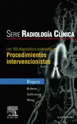 LOS 100 DIAGNÓSTICOS PRINCIPALES EN PROCEDIMIENTOS