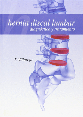 HERNIA DISCAL LUMBAR DIAG Y TRATAMIENTO