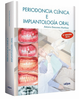 PERIODONCIA CLÍNICA E IMPLANTACIÓN ORAL