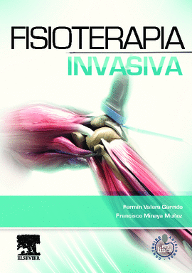 FISIOTERAPIA INVASIVA + ACCESO WEB